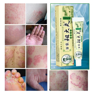 พร้อมส่ง Zudaifu เนื้อครีมสีชมพู ขนาด15g บำรุงผิวหนัง จบทุกป…