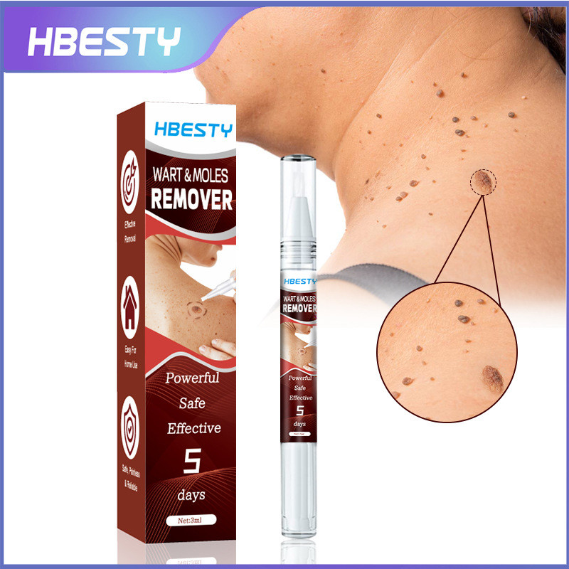 Yhbesty Skin ลบหูดปากกา Face Black Moles เนื้อ Thorns เนื้อเม็ดหูดปากกา