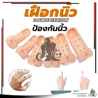 เฝือกนิ้ว เฝือกดามนิ้วพลาสติก ที่ดามนิ้ว finger splint นิ้วล…
