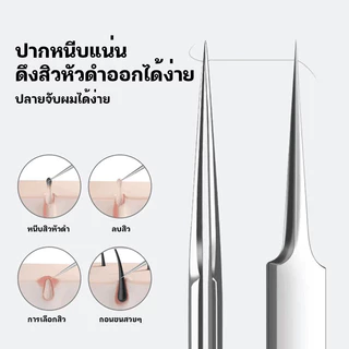 คีมหนีบสิว ที่กดสิว ที่ดึงสิวเสี้ยน กำจัดสิวเสี้ยน คีมดึงหัวสิว อุปกรณ์คีบสิวกดสิว ที่หนีบสิว แหนบดึงสิวเสี้ยน