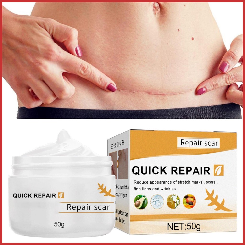 รอยแผลเป็นกระชับครีมรอยแผลเป็นโลชั่นสําหรับผิวผิวรอยแผลเป็น Repairing ครีมสําหรับ Bod Face Abdomen ก