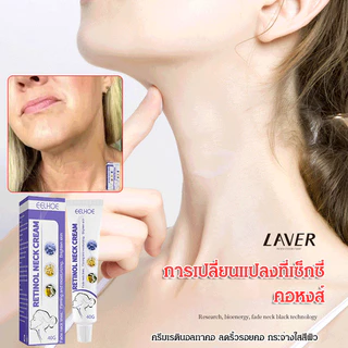 [1 แถม 1] EELHOE Retinol Neck Cream ครีมบำรุงผิวลำคอ เรตินอล ช่วยลดเลือนริ้วรอย ให้ผิวดูตึงกระชับ ชุ่มชื้น (40g)