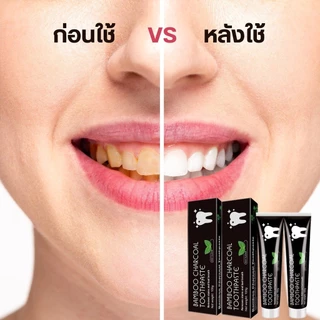 ยาสีฟันถ่านไม้ไผ่ แบมบู ลดฟันเหลือง ขจัดกลิ่นปาก ลมหายใจสดชื่น ขนาด 105 กรัม
