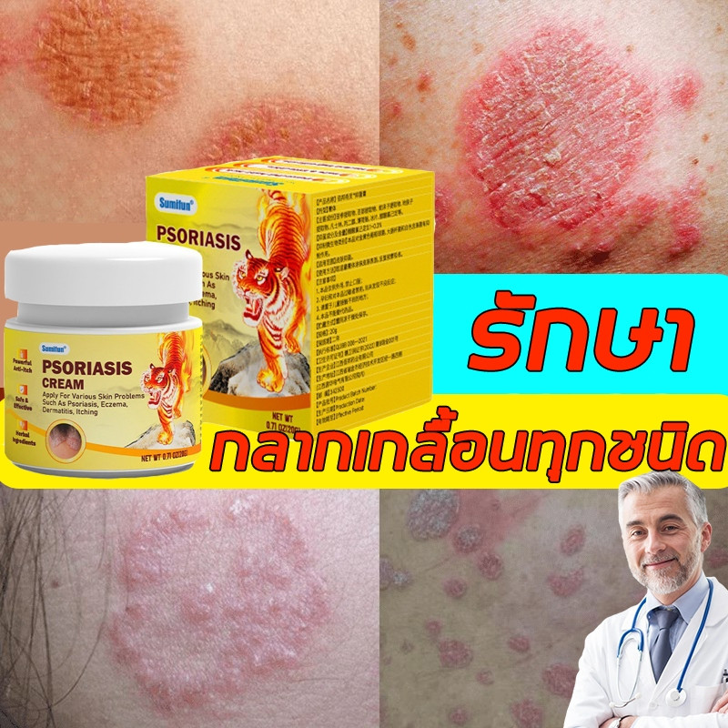 100% ครีมบรรเทาอาการคันที่มีประสิทธิภาพทากลากสารสกัดจากพืชใช้ได้ทั้งร่างกายสารสกัดจากพืชใช้ได้ทั้งตัวสารสกัดจากพืชใช้ได้ทั้งตัว20ก