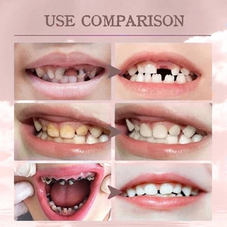 สเปรย์ป้องกันฟันผุ ปกป้องฟันของเด็ก เหมาะสำหรับเด็กอายุ 1-12 ปี Tooth Spray Children Baby Tooth Cleaning