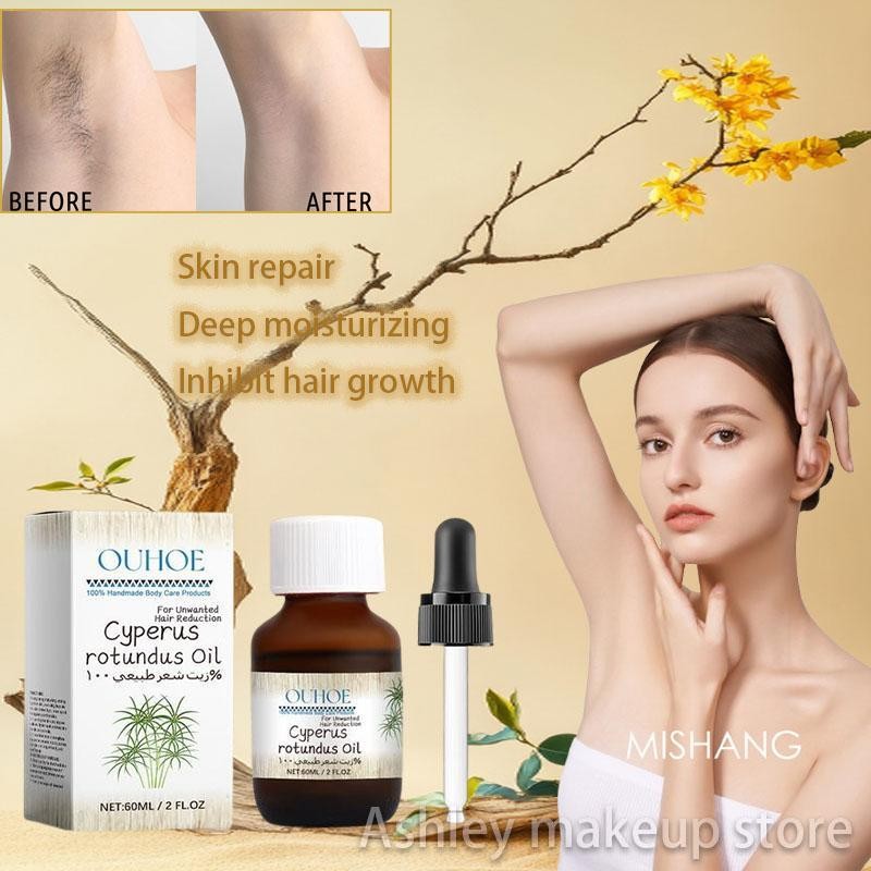 Cyperus Oil กําจัดขน Gentle Solution สําหรับผมไม่ต้องการ Cyperus Rotundus Oil สําหรับกําจัดขน Moisturizing และ teih