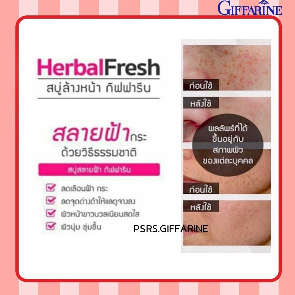 สบู่ล้างหน้าหัวไชเท้า กิฟฟารีน Herbal Fresh Radish Glycerin Soap GIFFARINE thumbnail 4