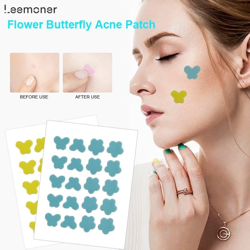 【Lemon】แผ่นแปะสิว สติกเกอร์แปะสิว ผีเสื้อ สีสันสดใส สําหรับติดตกแต่งสิว 20ชิ้น Acne Patches-LN