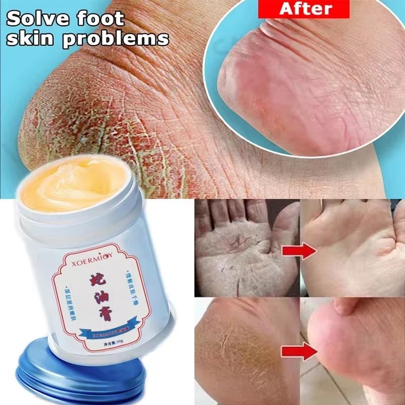 30g ผลิตภัณฑ์ความงามสมุนไพร Anti Crack Foot Cream Heel Cracking ผลิตภัณฑ์ซ่อมแซม Exfoliaation Dead Skin Removal Softening Moisturize เครื่องมือ