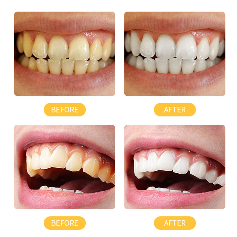 YTL [ซื้อ 1 แถม 1] ยาสีฟันขิงขิง ยาสีฟันสมุนไพร ลดกลิ่นปาก ฟันขาว ฟันแข็งแรง ทำให้ปากสดชื่น Toothpaste - รูปที่ 4