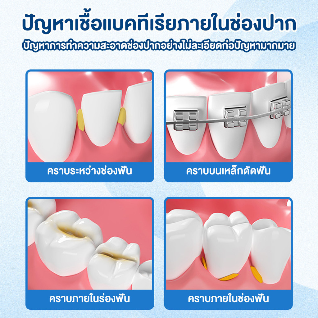 แปรงขัดซอกฟันสําหรับจัดฟันที่มีขนแปรงนุ่มและด้ามจับถนัดมือ แปรงซอกฟัน แปรงกระจุก - รูปที่ 2