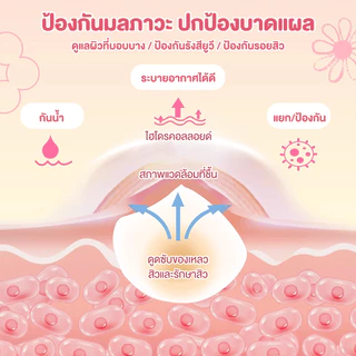 แผ่นซับสิว แผ่นสิว สําหรับติดตกแต่งสิว ดูดสิว สำหรับปกปิดจุดด่างใบหน้า การยึดเกาะที่แข็งแรง ไม่หลุดง่าย ลายการ์ตูน