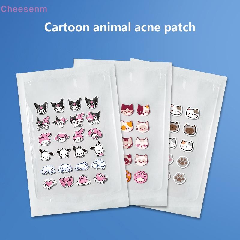 Cheesenm 20/24 ชิ้นสิว Pimple Patch สติกเกอร์สิว Remover เครื่องมือ Blemish Spot Facial Mask Skin Care Sanrio การ์ตูนซ่อนสิว TH