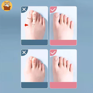 Am-az2Pc ซิลิโคน Toe Separator นิ้วฟุต Toe Spreader Hallux Valgus Bunion Corrector Toe Straightener Corrector Finger Separators