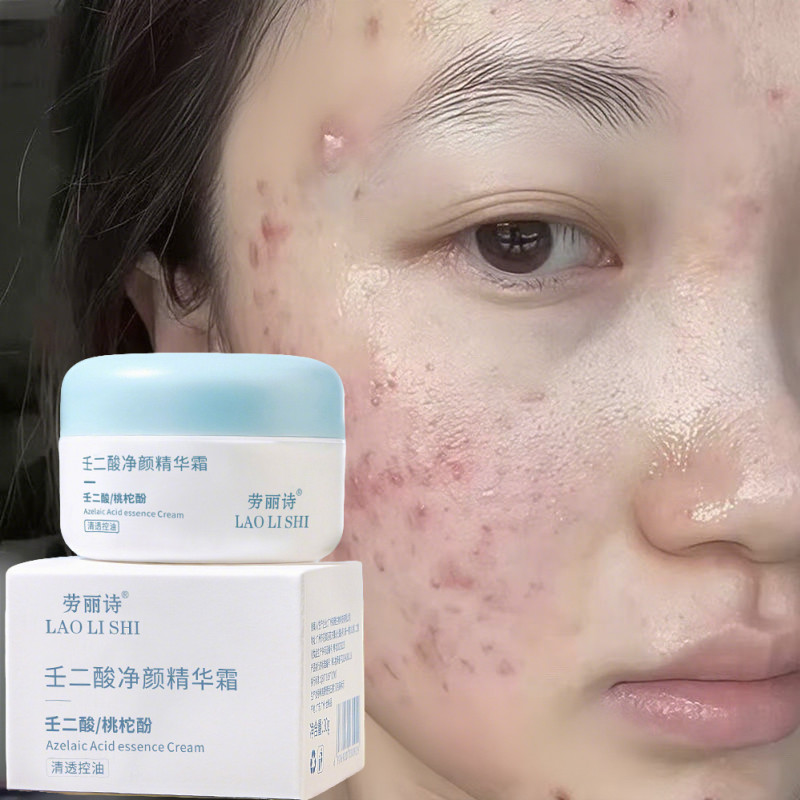 LAOLISHI Azelaic Acid Essence Cream รูขุมขนหดตัวปรับปรุงรอยแผลเป็นจากสิวควบคุมน้ํามันครีมป้องกันสิว