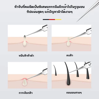 อุปกรณ์กำจัดสิว ที่กดสิว ที่เจาะบีบสิว คีมดึงหัวสิว ไม้กดสิว อุปกรณ์กำจัดสิว อุปกรณ์เครื่องมือสแตนเลสสำหรับกำจัดสิว