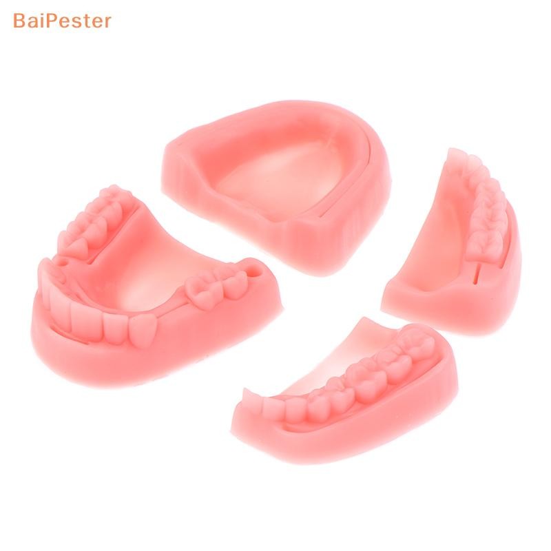 [BaiPester] โมเดลเย็บแผลในช่องปากจําลอง 4 ชิ้น อุปกรณ์ฝึกการสอนการเย็บหมากฝรั่ง - รูปที่ 2