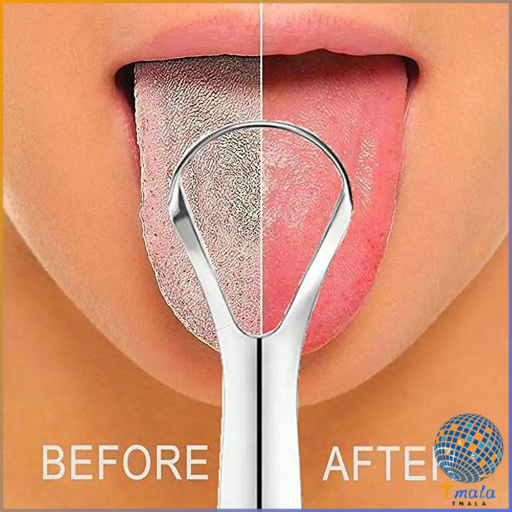 Tmala ที่ขูดลิ้น สเตนเลส รูปตัว U เซตขูด เคลือบ แบบพกพา พร้อมส่งในไทย tongue cleaning