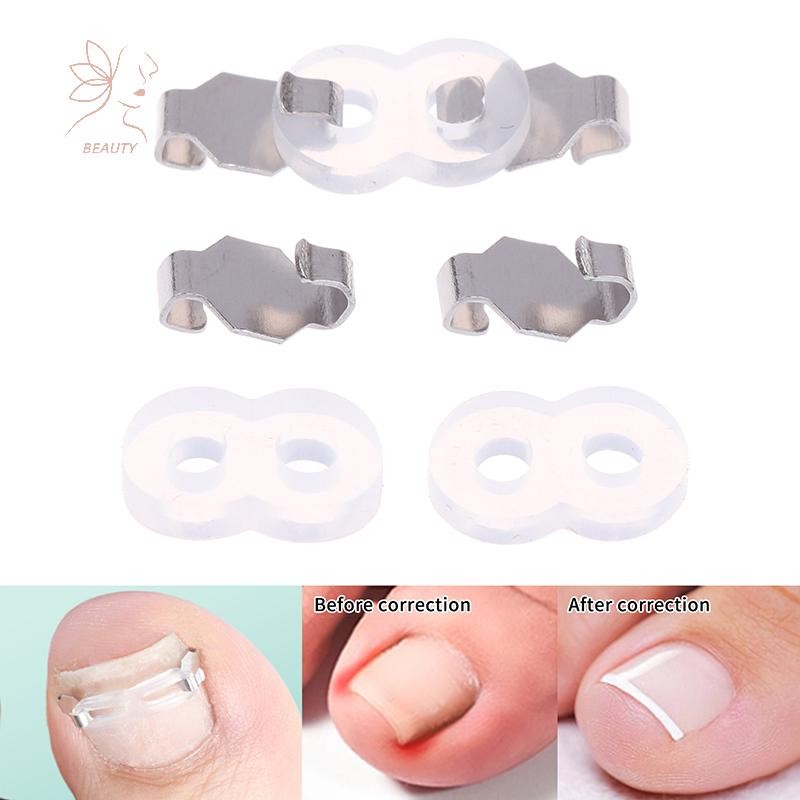 [maybeauty] 1/2 ชุดคุด Toenail Corrector เครื่องมือ Pedicure Recovered Toenail Treatment Foot Care Correction เครื่องมือ {TH}