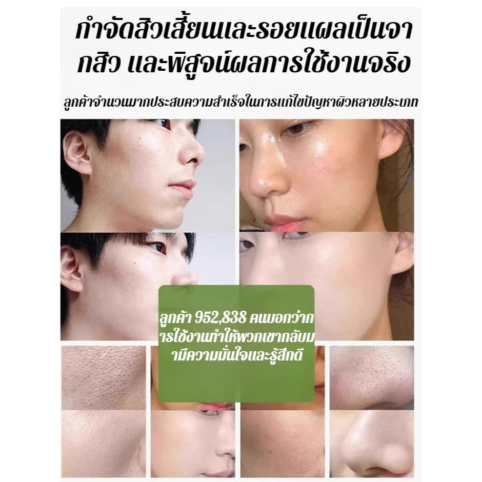 ของแท้💯สกินแคร์ มาส์กอโวคาโด้  มาส์กอโวคาโด้ ฟองฟู่ มาส์กฟอง มาร์คหน้า บํารุงผิวหน้า 10 วินาทีเกิดฟอง รูขุมขนหดตัว thumbnail 9