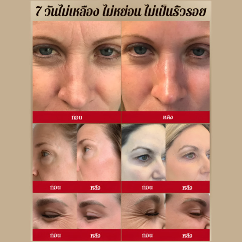 🔥โปรแรง 1แถม1🔥ครีมกระชับและลดริ้วรอยด้วยเปปไทด์/ครีมลดริ้วรอย 50g ต่อต้านริ้วรอย มอยเจอร์ไรเซอร์ ยกกระชับ ปรับผิวให้ตึง - รูปที่ 7