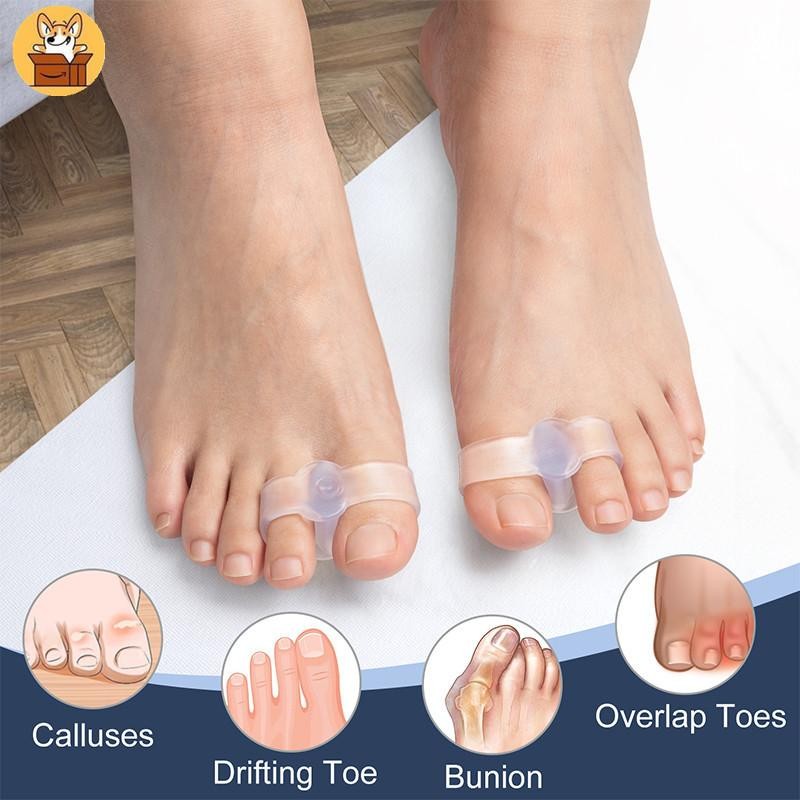 ชุดแยกนิ้วเท้าซิลิโคน 2 ชิ้น - เหมาะสําหรับ Hallux Valgus และ Overlopping Toe Correction