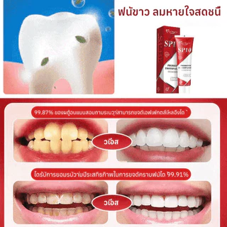 ยาสีฟันโปรไบโอติก SP-10 ลดคราบเหลืองจากชา/กาแฟ ปราศจาก SLS ลดกลิ่นปาก