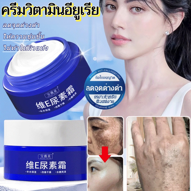 【ทาปุ๊บลดจุดด่างดำ】ครีมยูเรียลดจุดด่างดำ/ของแท้100% ออร่าไวท์เทนนิ่งครีม แก้ฝ้า/ ฝ้า กระ จุดด่างดำ ครีมยูเรีย เพื่อผิวขาว กระจ่างใส
