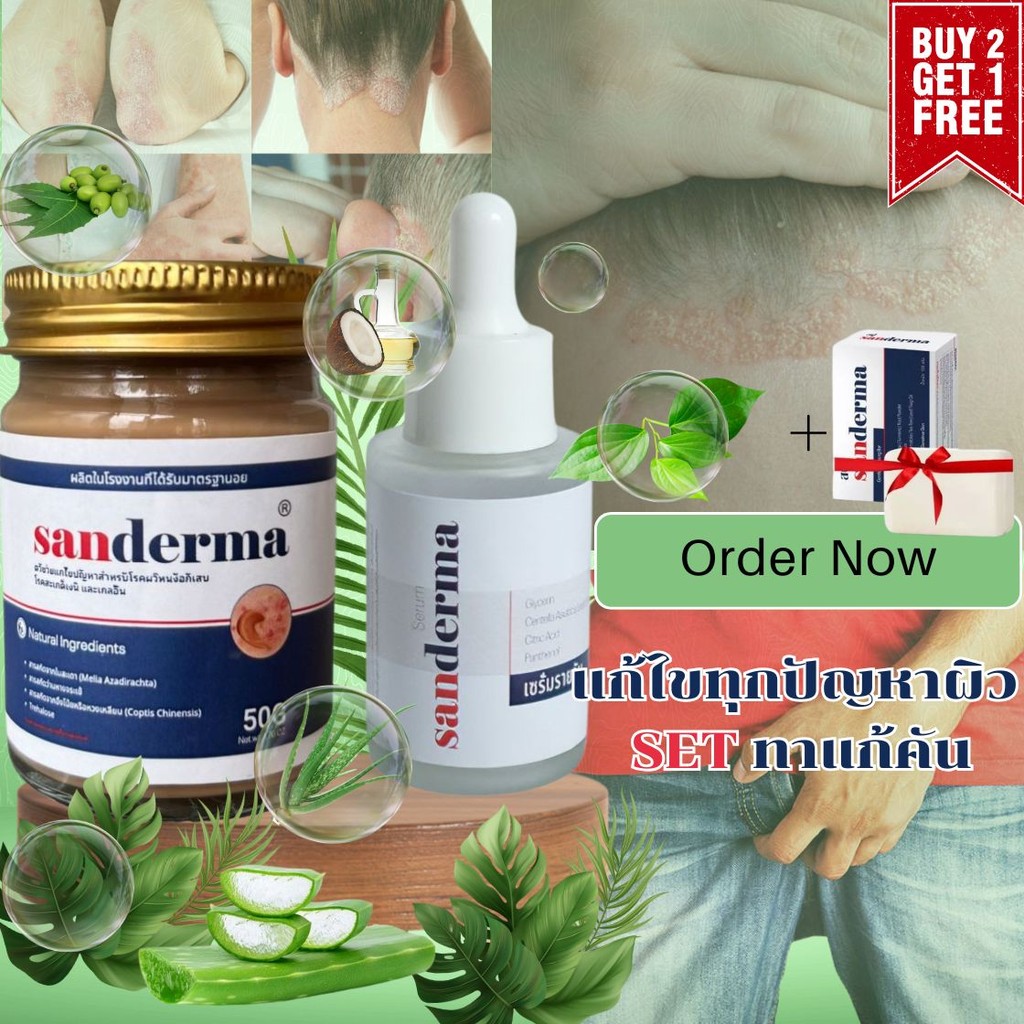 [COMBO CREAM & SERUM] ทาแก้คัน ครีมลดอาการคัน ทาแก้คัน ผิวหนังทากากเกลื้อน สารสกัดจากพืชใช้ได้ทั้งตัวบอกลาผิวคันได้ง่ายๆ