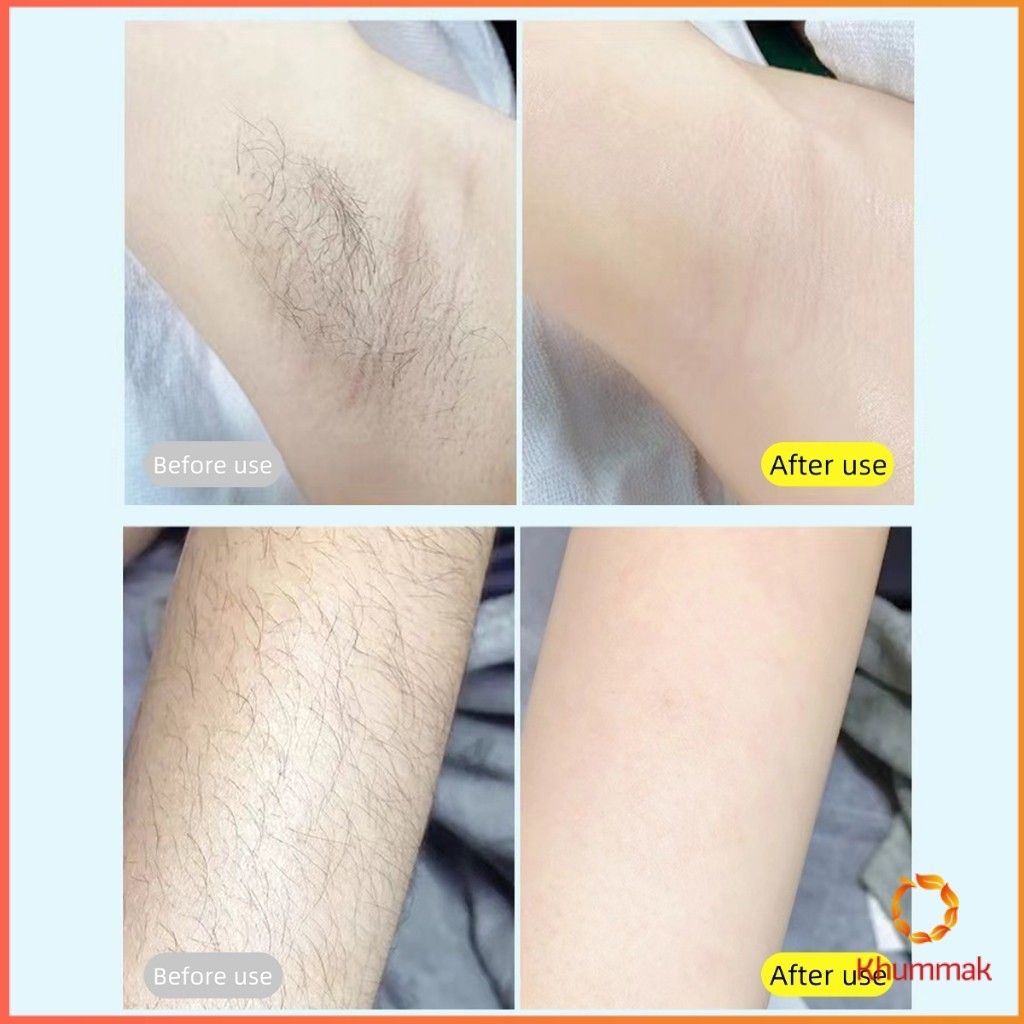 Khummak มีดโกนสำหรับสุภาพสตรี มีดโกนหนวด มีดโกนอเนกประสงค์ Ladies Razor ราคา ถูกที่สุด ดีลบีเคเค แกลเลอรีภาพที่ 5