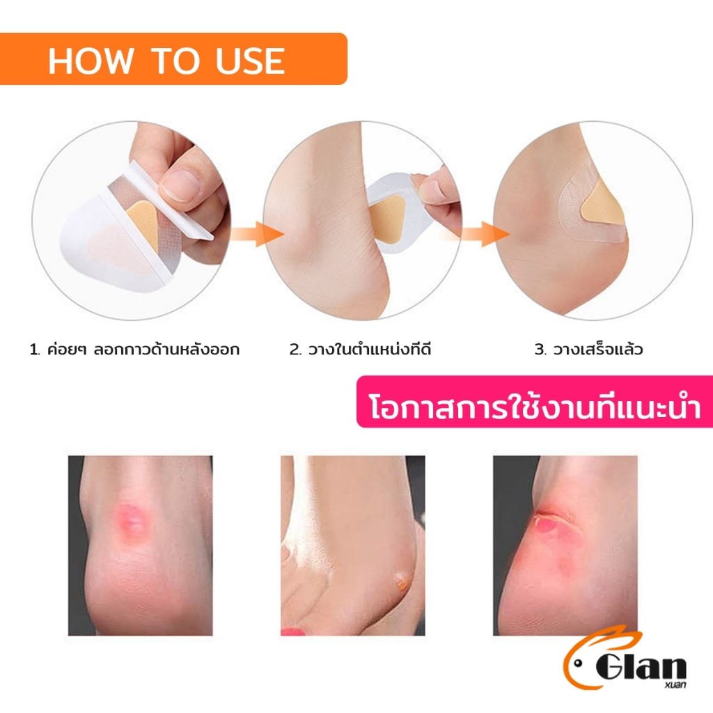 Glanxuan 10Pcs/pack สติกเกอร์เจล ป้องกันอาการการกัดของรองเท้า สําหรับติดเท้า นุ่มสบาย ไม่ทำร้ายผิว heel stickers