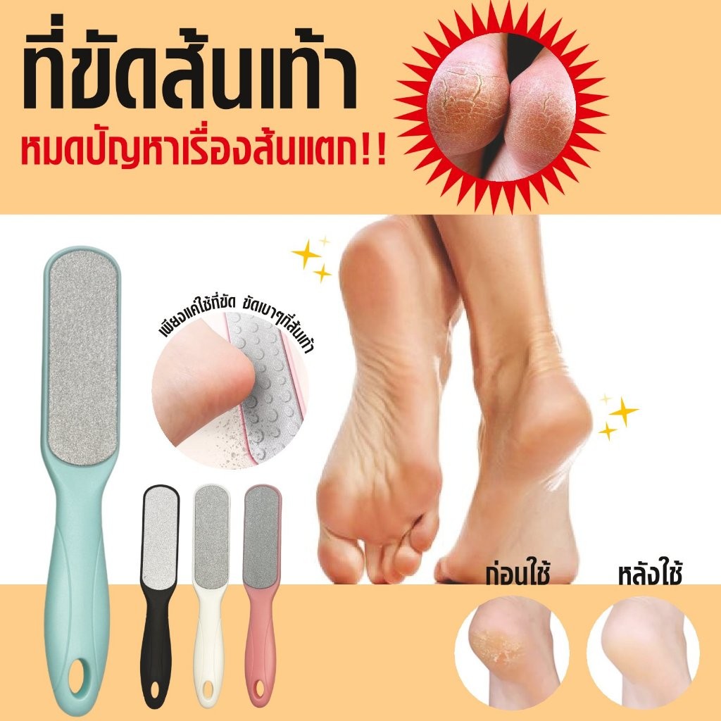 BX-4261 ตะไบ ขัดส้นเท้าแตก ตะไบ หินขัดเท้า ที่ขัดส้นเท้า
