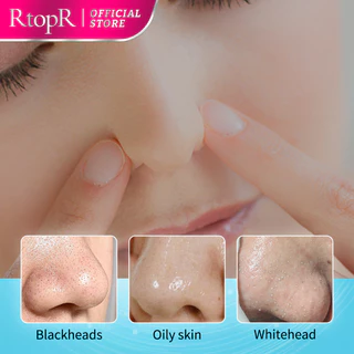 RtopR FDA Mango Blackhead Remover Mask มาส์กจมูกมะม่วงจากพืช - ช่วยขจัดสิวหัวดำและสิวอุดตัน ลดขนาดรูขุมขน ทำความสะอาดลึก เหมาะสำหรับผู้ชายและผู้หญิง ขนาด 10ml + 50pcs skincare