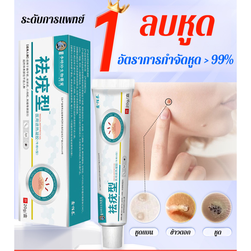 From TH】เจลกําจัดหูดทางการแพทย์ เจลจากแหล่งชีวภาพของ หลิงหลิง