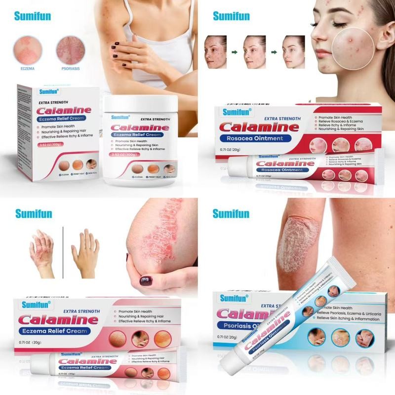 20ml Extra Strength Calamine Rosacea/โรคสะเก็ดเงินครีมซ่อมแซมสิว Face Soothing Cream Pimple Treatment Skin Care สําหรับเท้า/มือ/ร่างกายกลากบรรเทา 100g ขนาดใหญ่