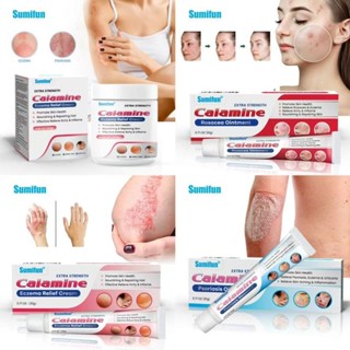 20ml Extra Strength Calamine Rosacea/โรคสะเก็ดเงินครีมซ่อมแซ…