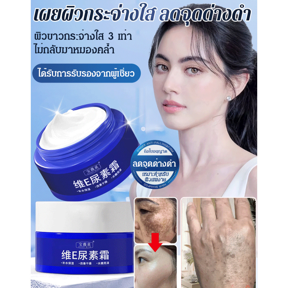 Urea Cream One-touch Spot-Fade Aging Spots Maular Skin Care ครีมไวท์เทนนิ่ง
