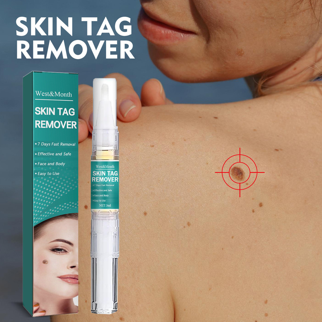 West & Month Ke Wart Pen Deep Cleansing Ke Wart ลบข้าวโพดเนื้ออนุภาคซ่อมแซม Smooth Skin Ke Wart Loti