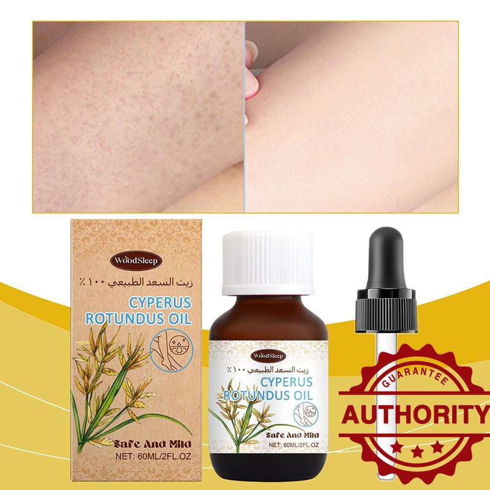กําจัดขน Cyperus Oil Nourishing น้ํามันผมระยะยาว Body Removal J9v2