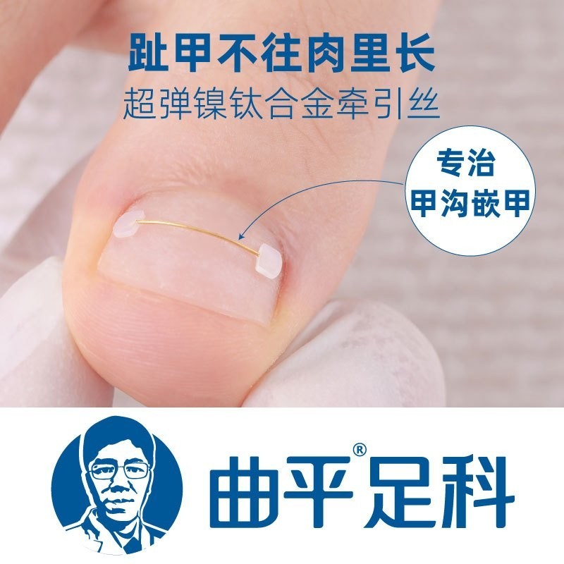 Quping Doctor Nail Groove เล็บคุด Memory Steel Wire Corrector Nail Corrector Patch Toenail Nail Tie 