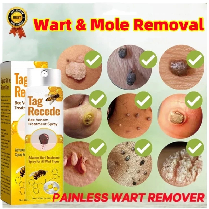 Bee Venom remover Skin tag remover ที่มีประโยชน์ Bee Venom สเปรย์แท็ก Recede Bee Venom สเปรย์ Bee Ve