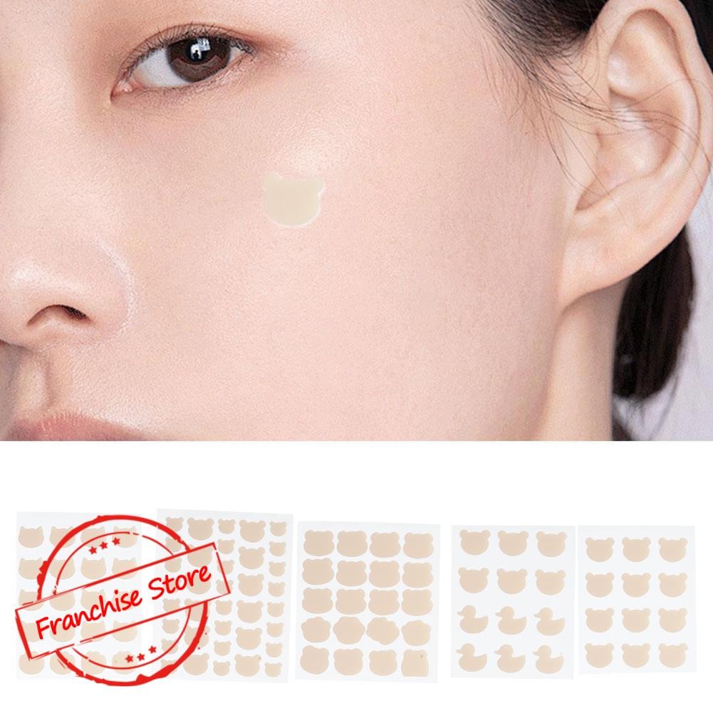 แผ่น Skin Tone Water-based Gel Acne Patch สําหรับครอบคลุมและการดูแลสําหรับ E8w2
