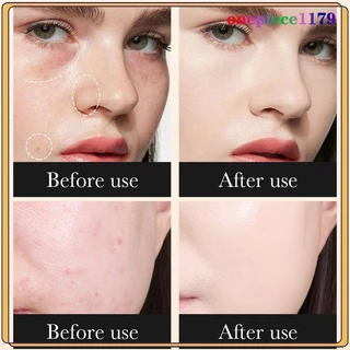รองพื้น บีบีครีม ครีมกันแดดหน้า Sadoer 9 in1 SPF50+pa+++คอนซีลเลอร์ แบบน้ำ ครีมรองพื้น ปกปิดดี ปกปิดริ้วรอยสิว BB Cream