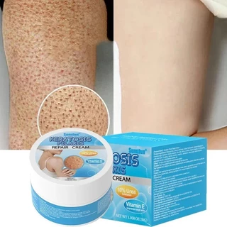 Keratosis Pilaris Repair cream Bumpy Rough Chicken Follicle Skin Repair Strawberry Legs Removal Dry Skin Care