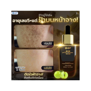 เซรั่มลดฝ้า ยันฮี [ของแท้ 100% รับประกัน] Yanhee Anti Melasma Serum ลดฝ้า กระ จุดด่างดำ 1 ขวด
