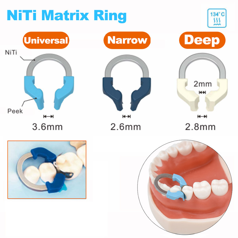 1 ชิ้นทันตกรรม Matrix Bands NITI โลหะ Matrices Clamp แหวนส่วน Contoured Matrix ระบบหนีบ Autoclavable เครื่องมือทันตกรรม