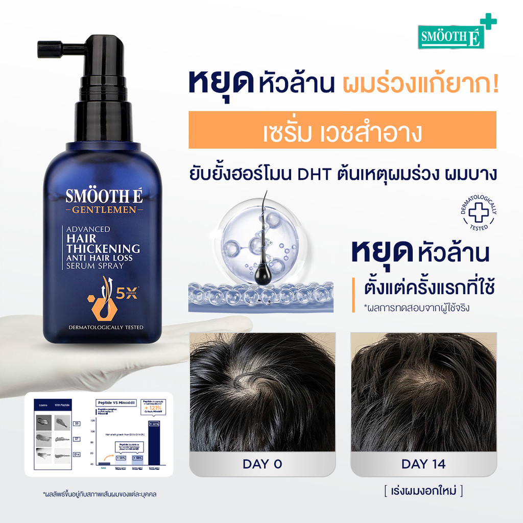 Smooth E Anti Hair Loss for Gentlemen Set แชมพูยา ลดผมร่วง กระตุ้นผมหนาจากราก ช่วยยับยั้งฮอร์โมน DHT สำหรับผู้ชาย