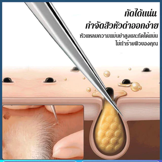 ✅แหนบเซลล์สำหรับร้านเสริมสวยจากเยอรมนี✅ ชุดรักษาสิว ที่หนีบเซลล์คุณภาพสูงทนทาน มือปราบสิวหัวดำ เครื่องมือความงาม เข็มสิว