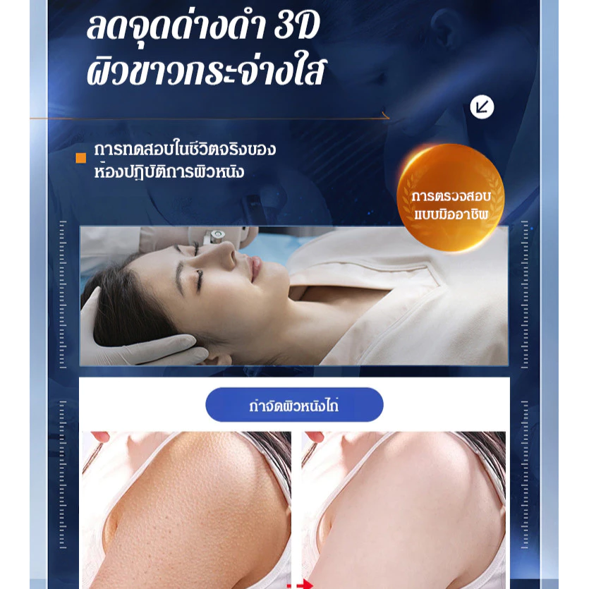 🔥MY HOT🔥【จุดด่างดำและจุดเหลืองหายไป】ครีมลดเลือนจุดด่างดำ Urea 淡斑尿素霜70g วิตามินอีบำรุงผิวให้ความชุ่มชื้นและปรับผิวกระจ่างใส/ครีมบำรุงผิวลดเลือนริ้วรอย/ครีมวิตามินอีไวท์เทนนิ่งปรับผิวกระจ่างใส thumbnail 8