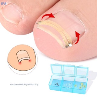 IFA คุด Toenail Corrector Pedicure กู้คืน Embed Toe Nail Tre…